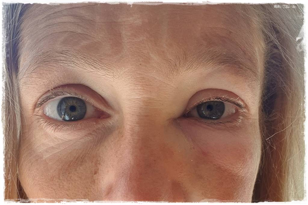 Gaśnica na osy 9 Gaśnica na osy 9